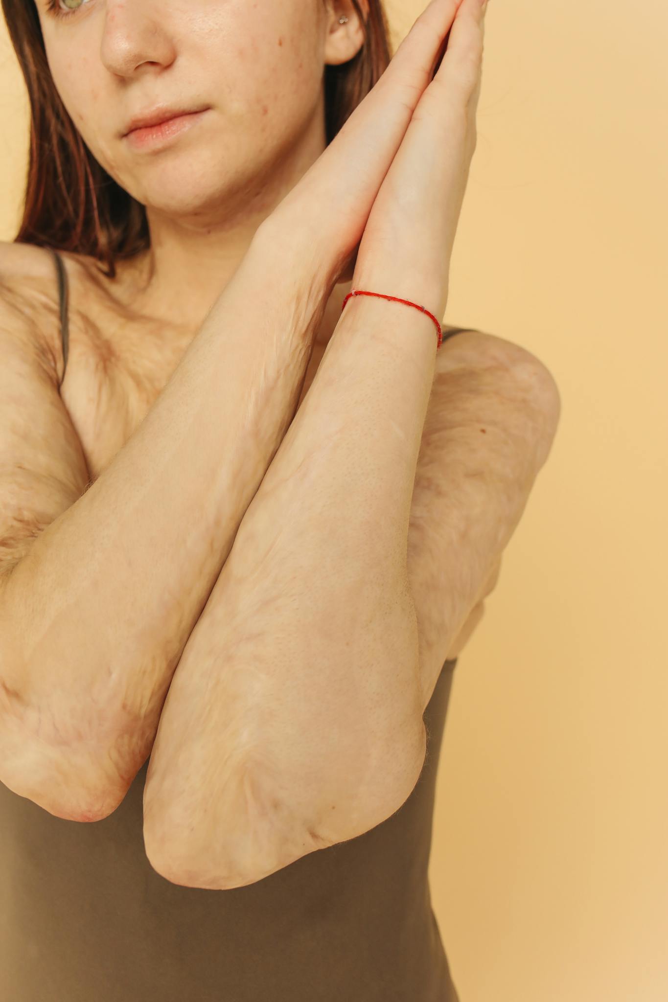 A close-up shot highlighting a woman's arms with visible scars, symbolizing resilience.